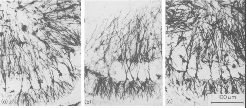 How Hibernating Rodents Inspire Human Hibernation Technology?