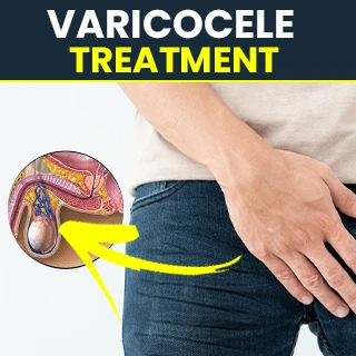 Varicocele Natural Treatment: Remedies to Try at Home