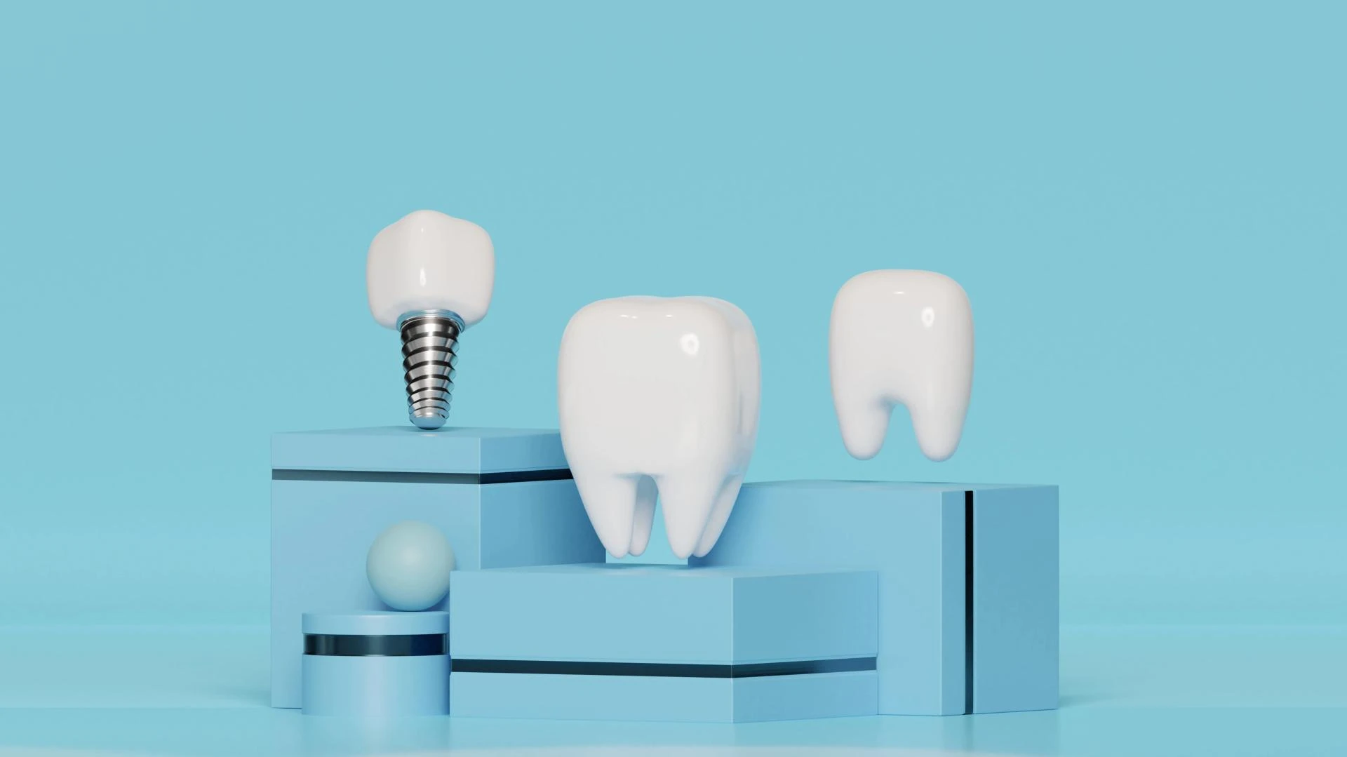 Minimum Age Requirement for Dental Implants: In-Depth Explanation