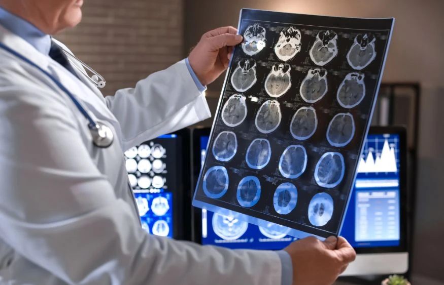 Preparing for Your MRI Brain Scan: Tips for a Smooth Experience