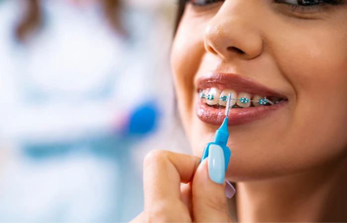 Caring for Your Braces: Tips for a Smooth Journey