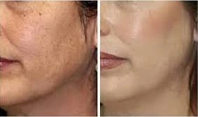 Best Dermatologist in Chandigarh: Leading Skin Clinic in Chandigarh for Superior Care
