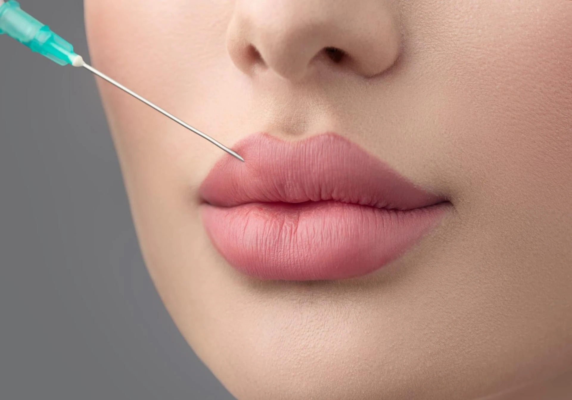 Why Dubai is the Best Destination for Russian Lip Fillers Treatments