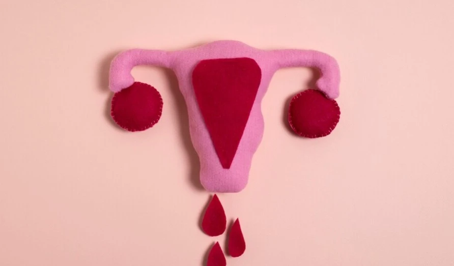 Heavy Periods: Menorrhagia Causes, Symptoms, and Treatment