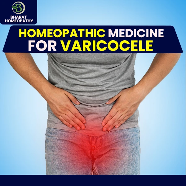 Best Varicocele Treatment Without Surgery: How Homeopathy Provides Natural Relief
