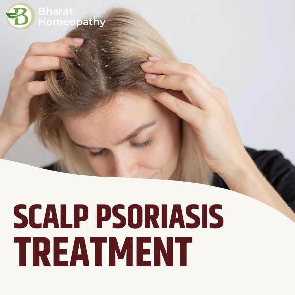 The #1 Natural Remedy for Scalp Psoriasis That Actually Works!