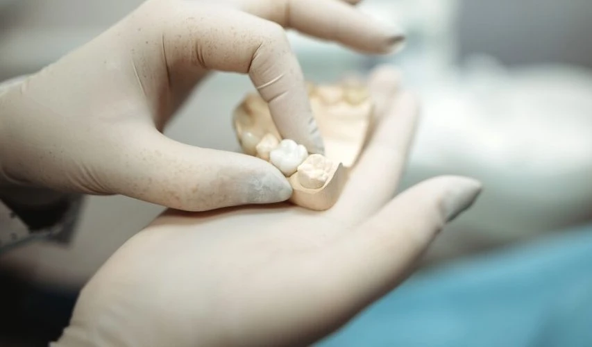 Restoring Smiles and Confidence: Crown Treatment Options in Ipswich