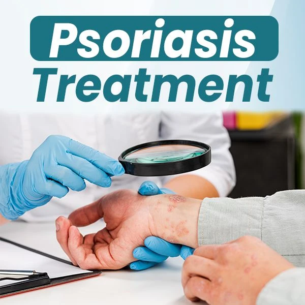 Permanent Solution for Psoriasis: How to Heal Naturally