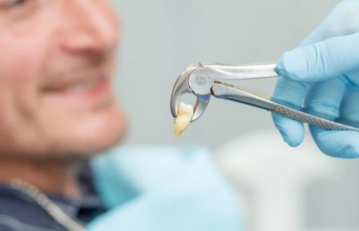 Can You Keep Your Wisdom Teeth? When Removal Isn’t Necessary