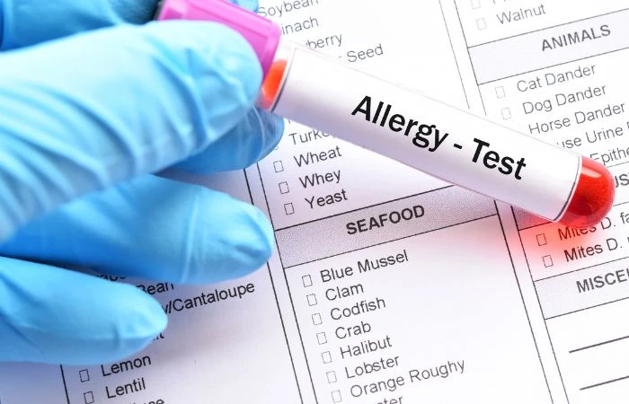 Food Allergy Testing: A Key to Managing Your Symptoms Effectively