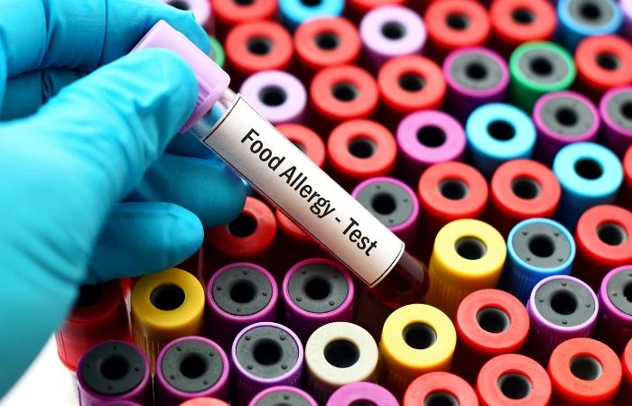 Food Allergy Testing: A Key to Managing Your Symptoms Effectively