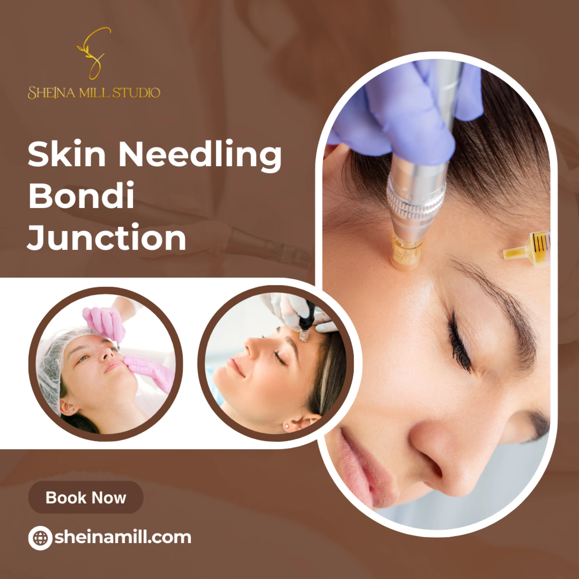 Skin Needling Sydney: Unlock Radiant Skin with Sheina Mill in Bondi Junction