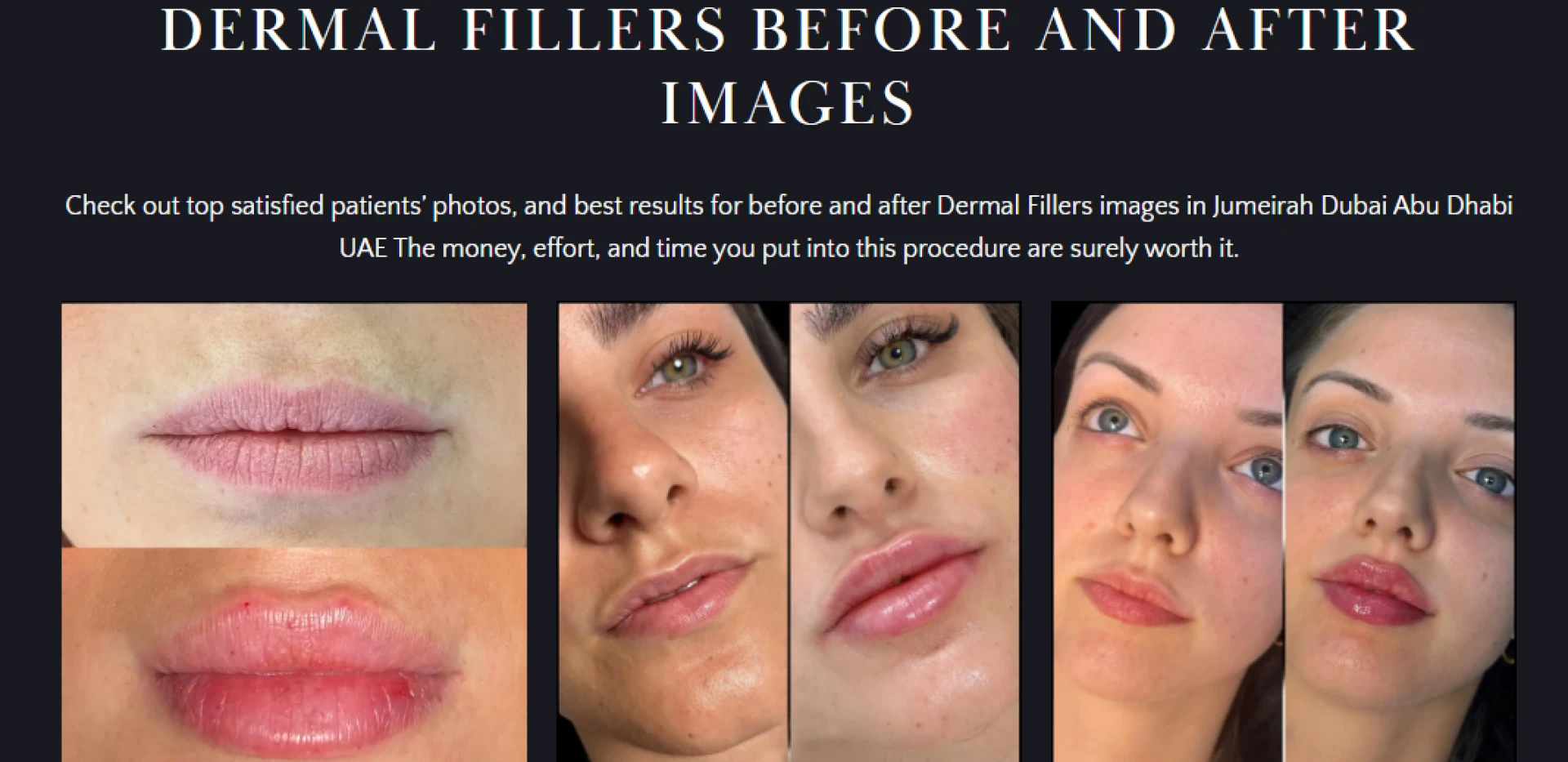 How to Choose the Best Clinic for Dermal Fillers in Dubai?