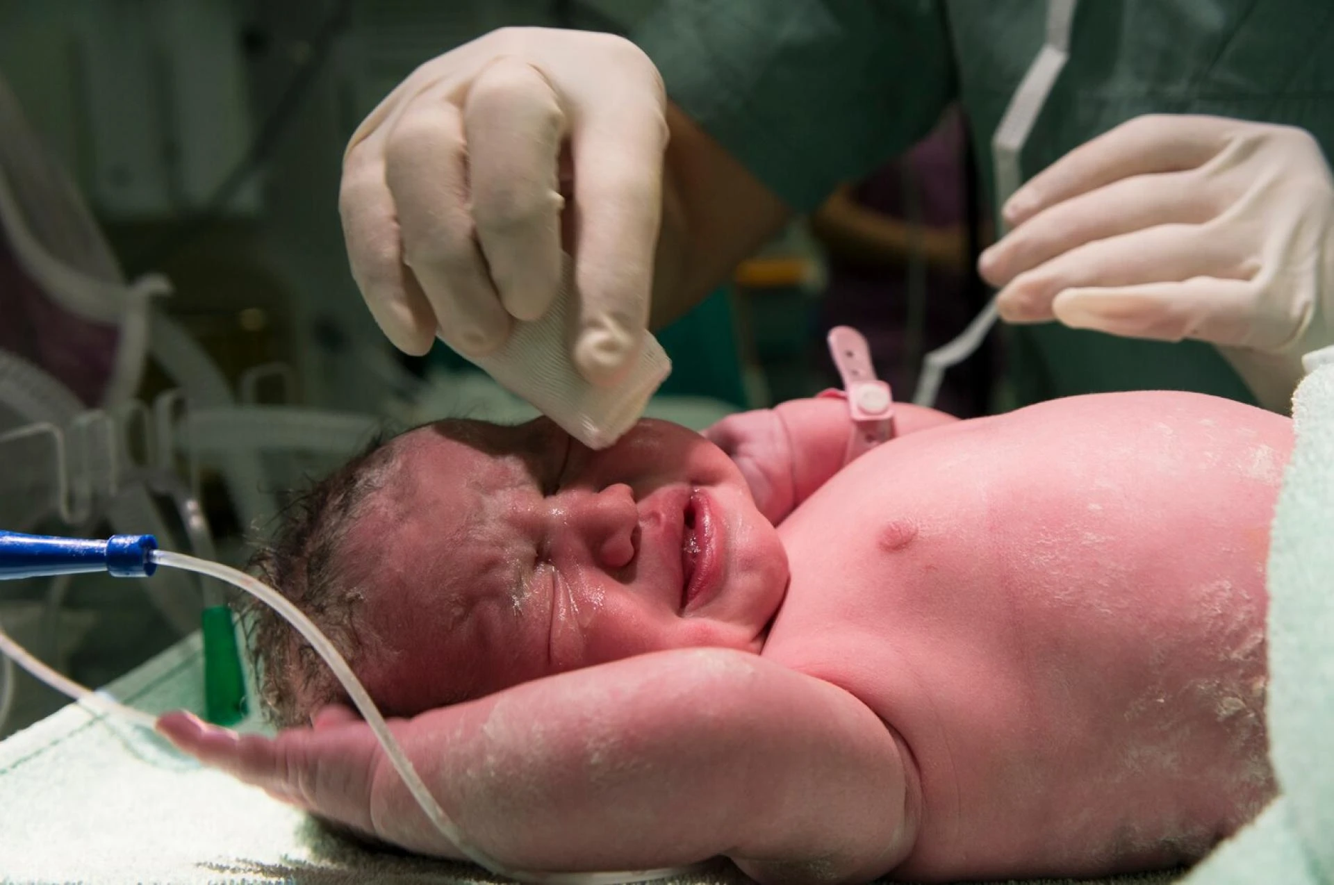 Preterm Birth: Causes, Risks, and Advances in Neonatal Care