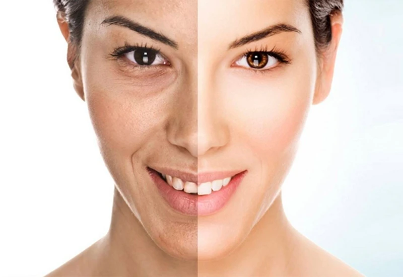 Datura Aesthetics Clinic: The Ultimate Destination for Skin & Hair Care in Mahadevapura