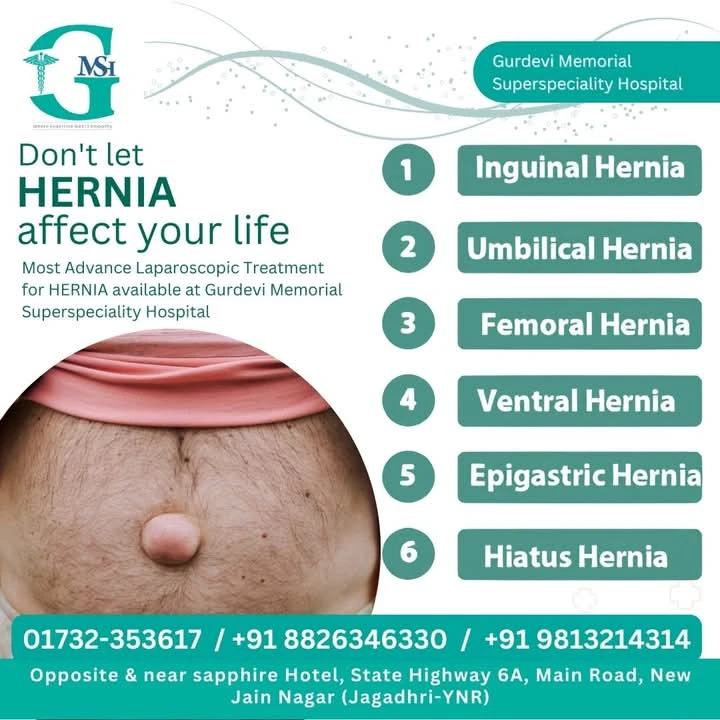 Hernia Operation in Yamunanagar at GM SuperSpeciality Hospital by Trusted Surgeons