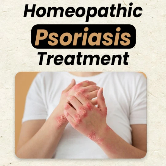 The Secret to Clear Skin: Natural Treatments for Psoriasis That Work