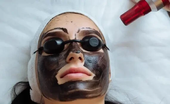 Everything You Need To Know About Carbon Peel Treatment