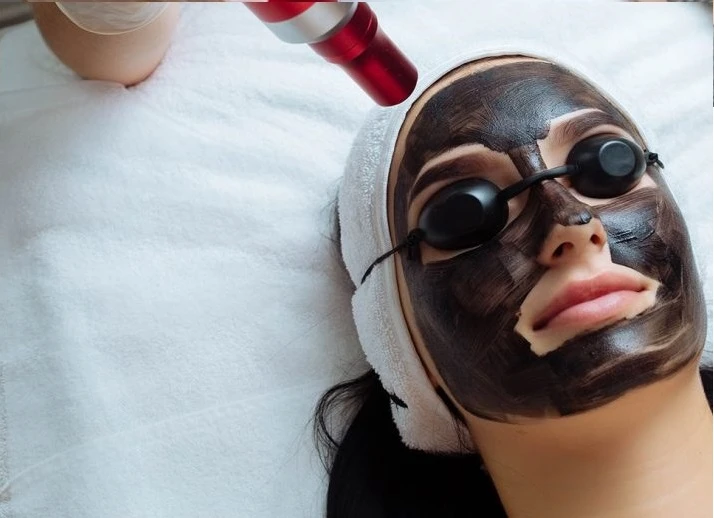 Everything You Need To Know About Carbon Peel Treatment