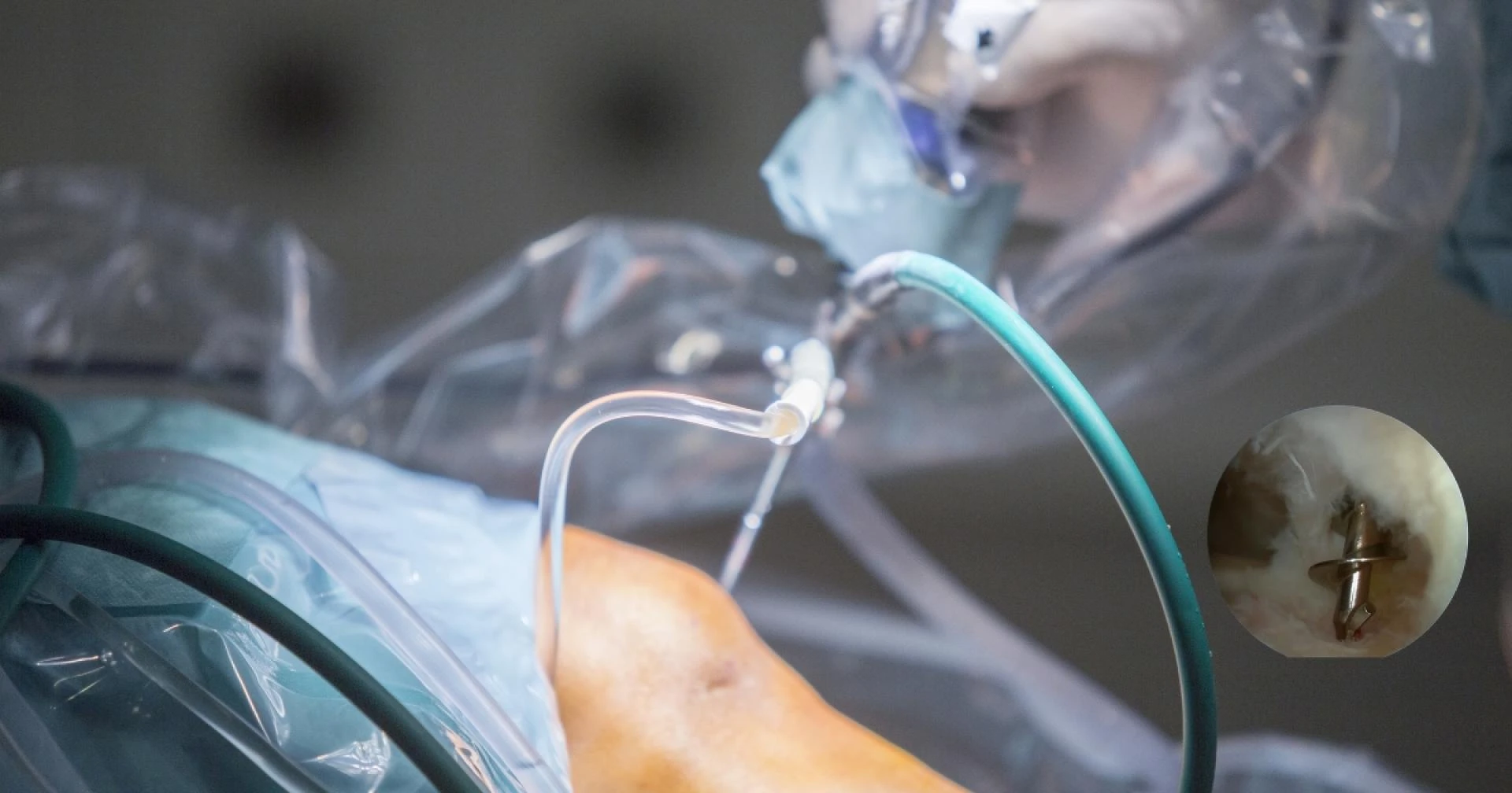 Expert Arthroscopic Surgery in Lahore – Fast Recovery, Minimal Pain