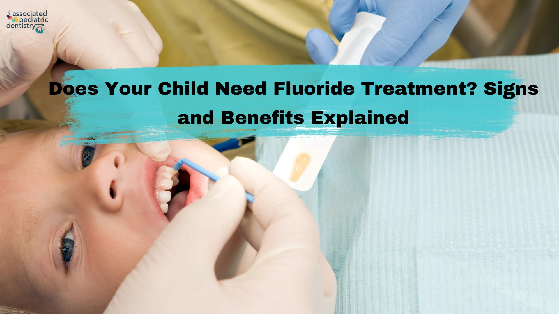 Does Your Child Need Fluoride Treatment? Signs and Benefits Explained