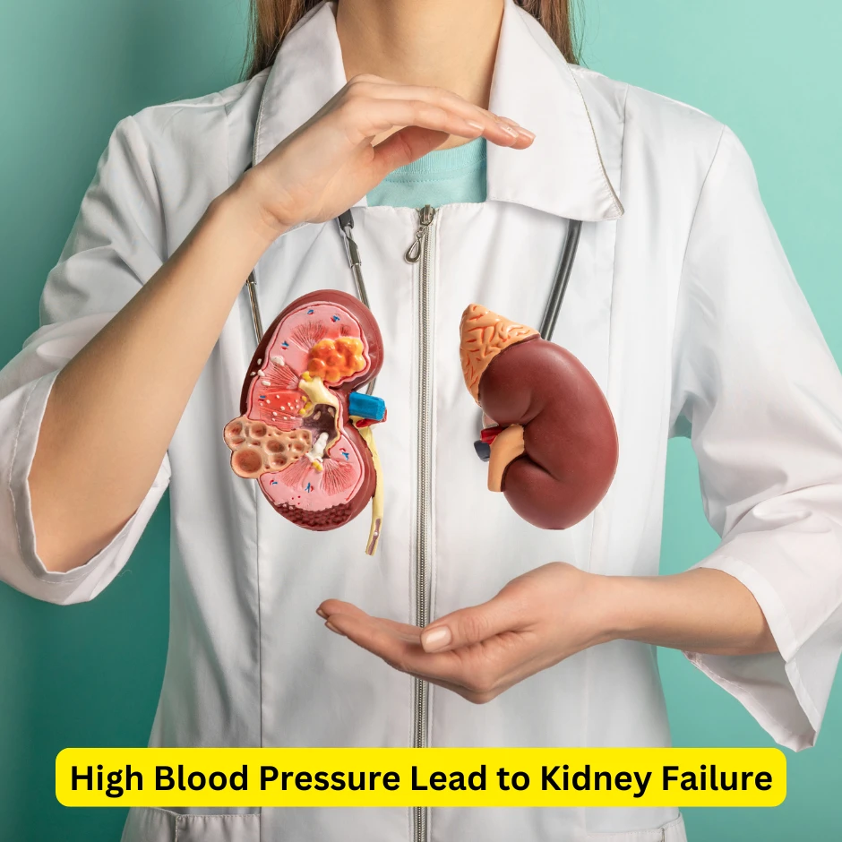 Can High Blood Pressure Lead to Kidney Failure?