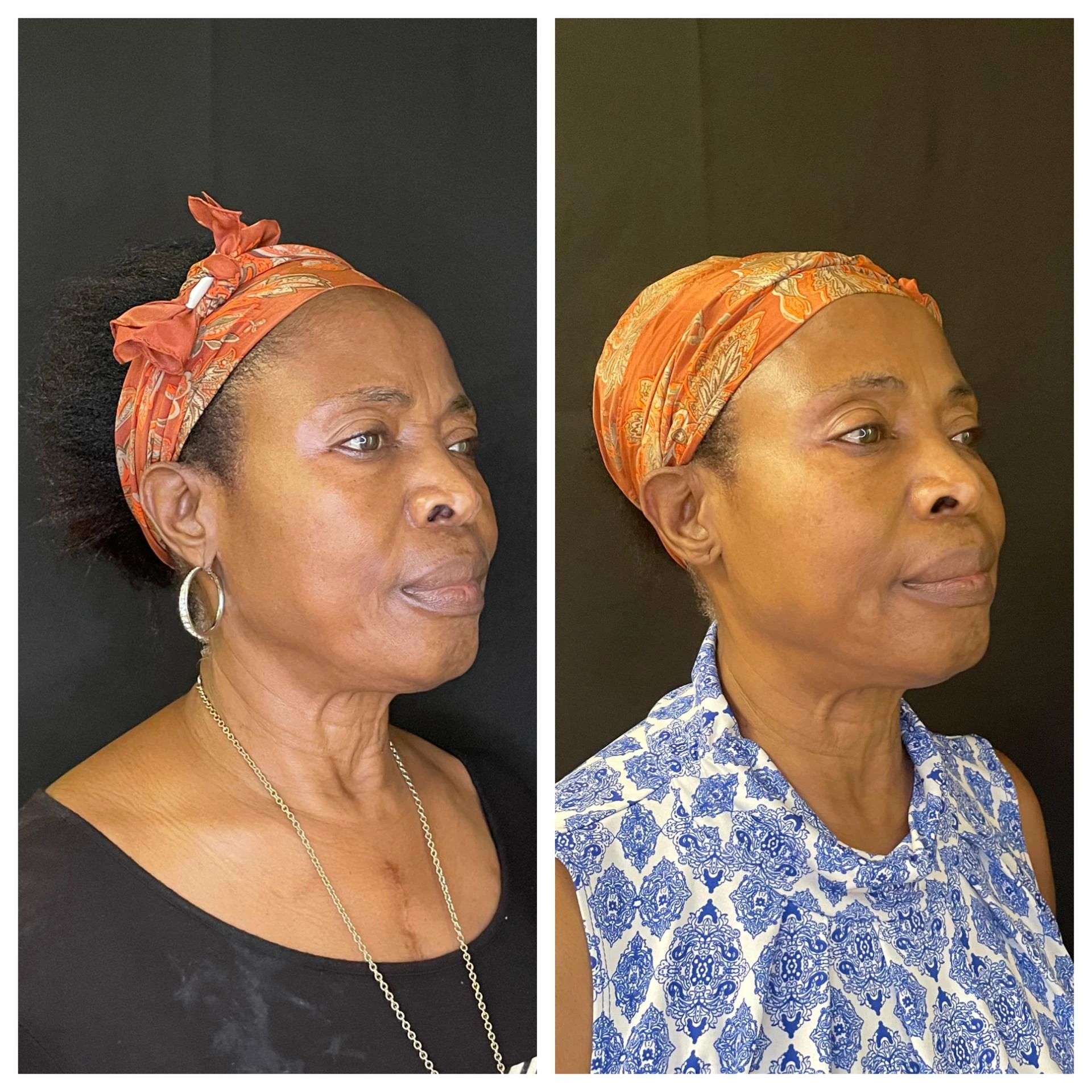 Balancing Beauty with Women’s Wellness in NYC – Cosmetic Injectables with Tailored Aesthetics Plans