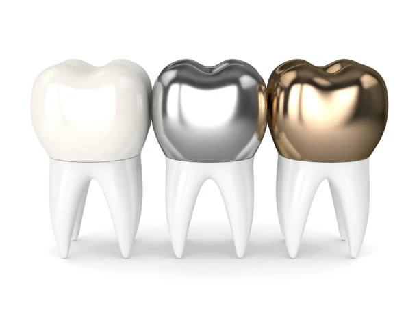 8 Essential Facts About Dental Crowns
