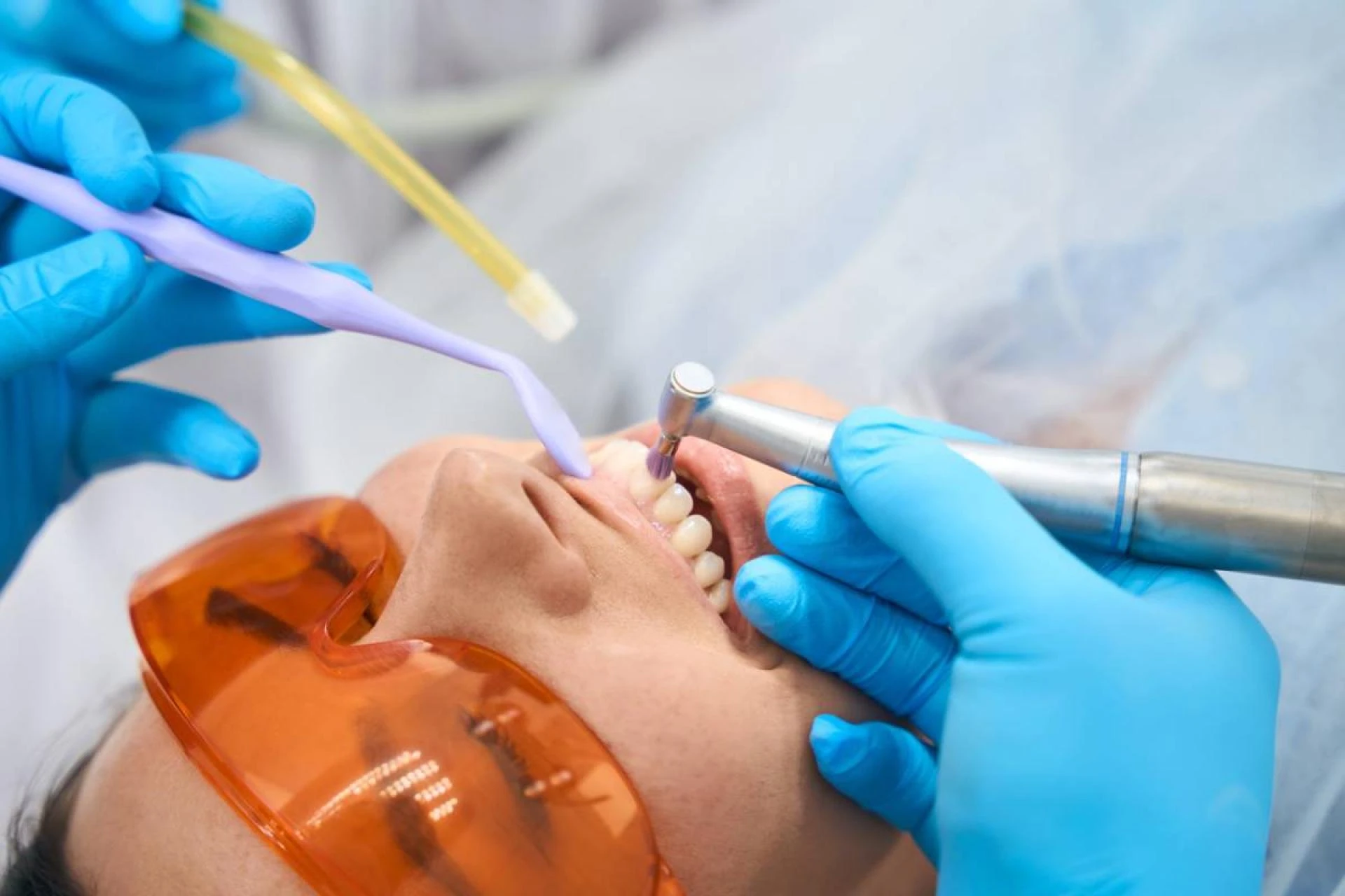 Fast and Effective Emergency Root Canal Services Near You