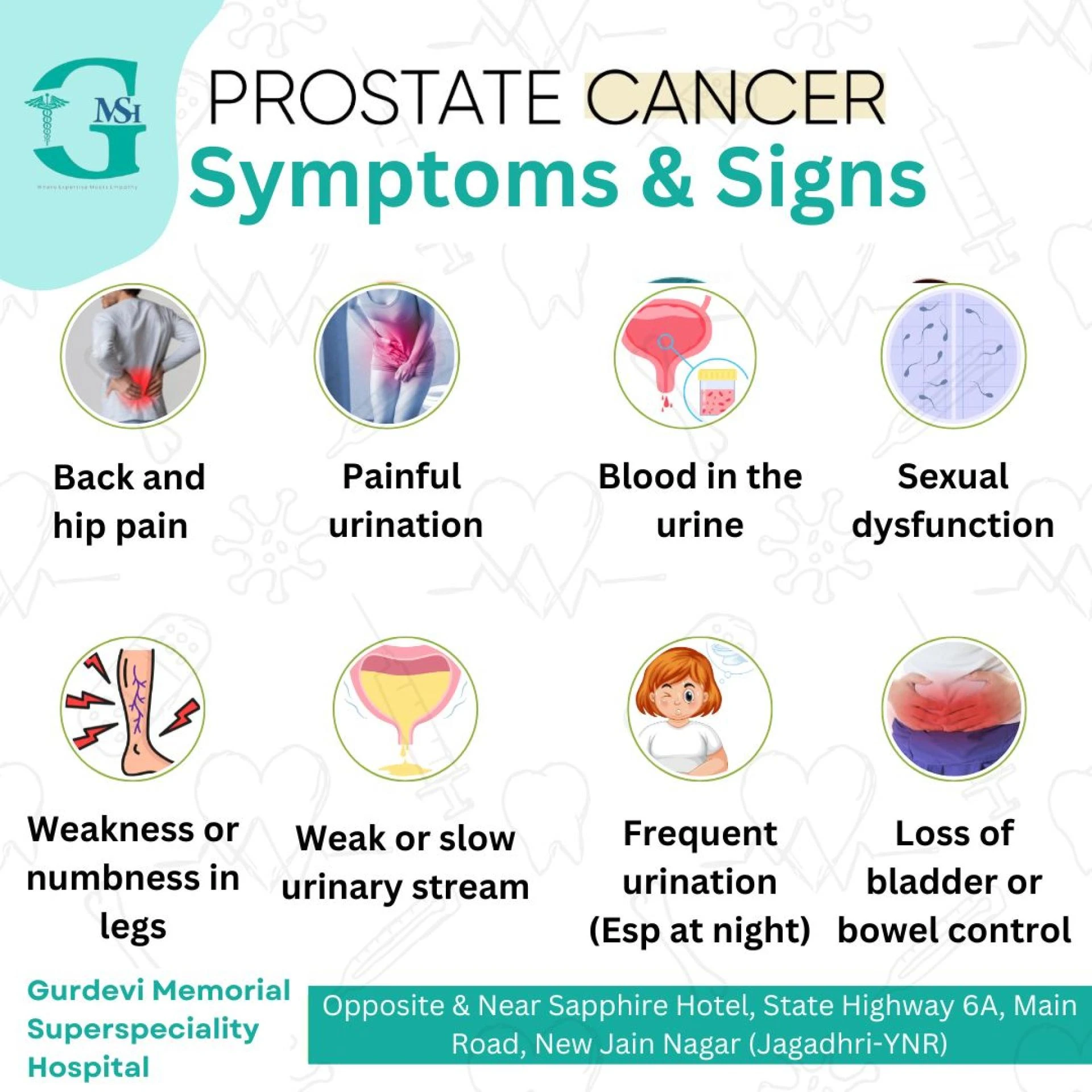 Prostate cancer treatment in Yamunanagar Made Easy at GM SuperSpeciality Hospital