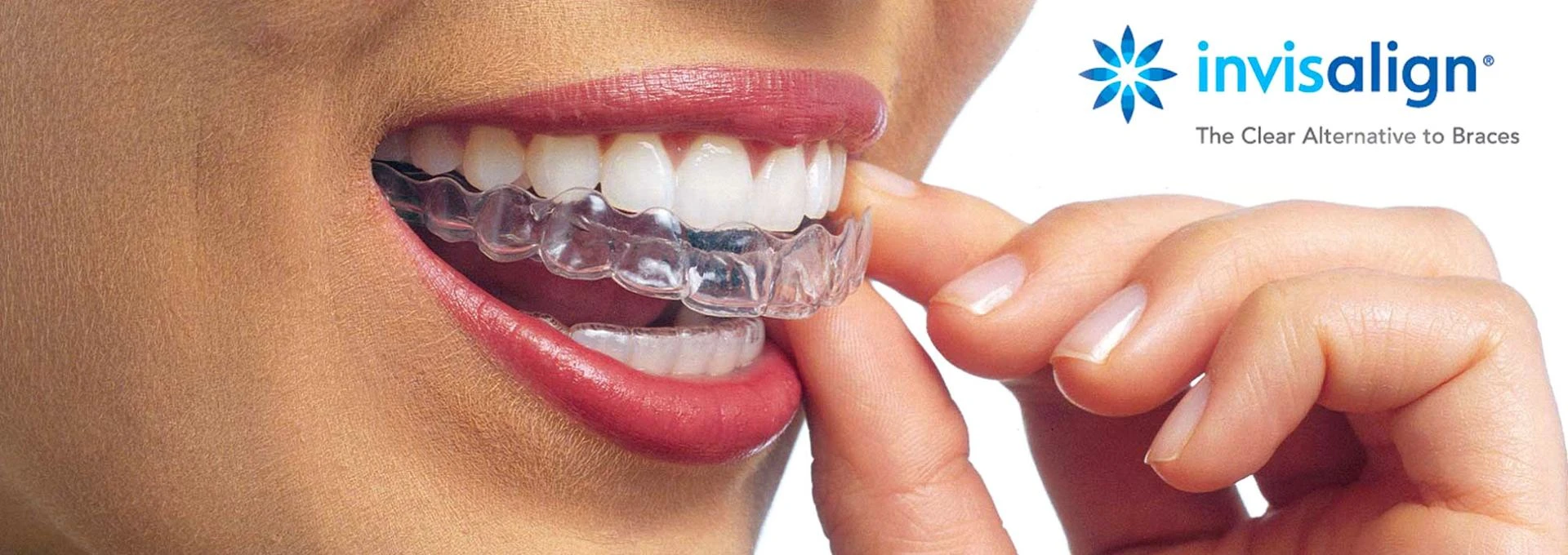 The Power of Cosmetic Dentistry and Invisalign at Chester Springs Dental