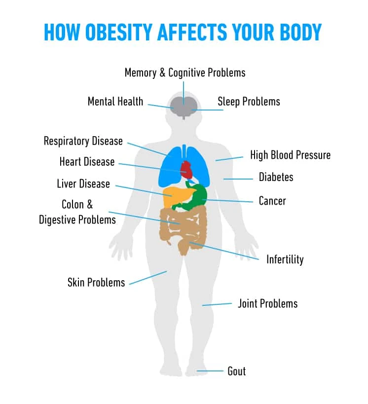 Understanding Obesity: How Obesity affects day to day life and how to get healthier