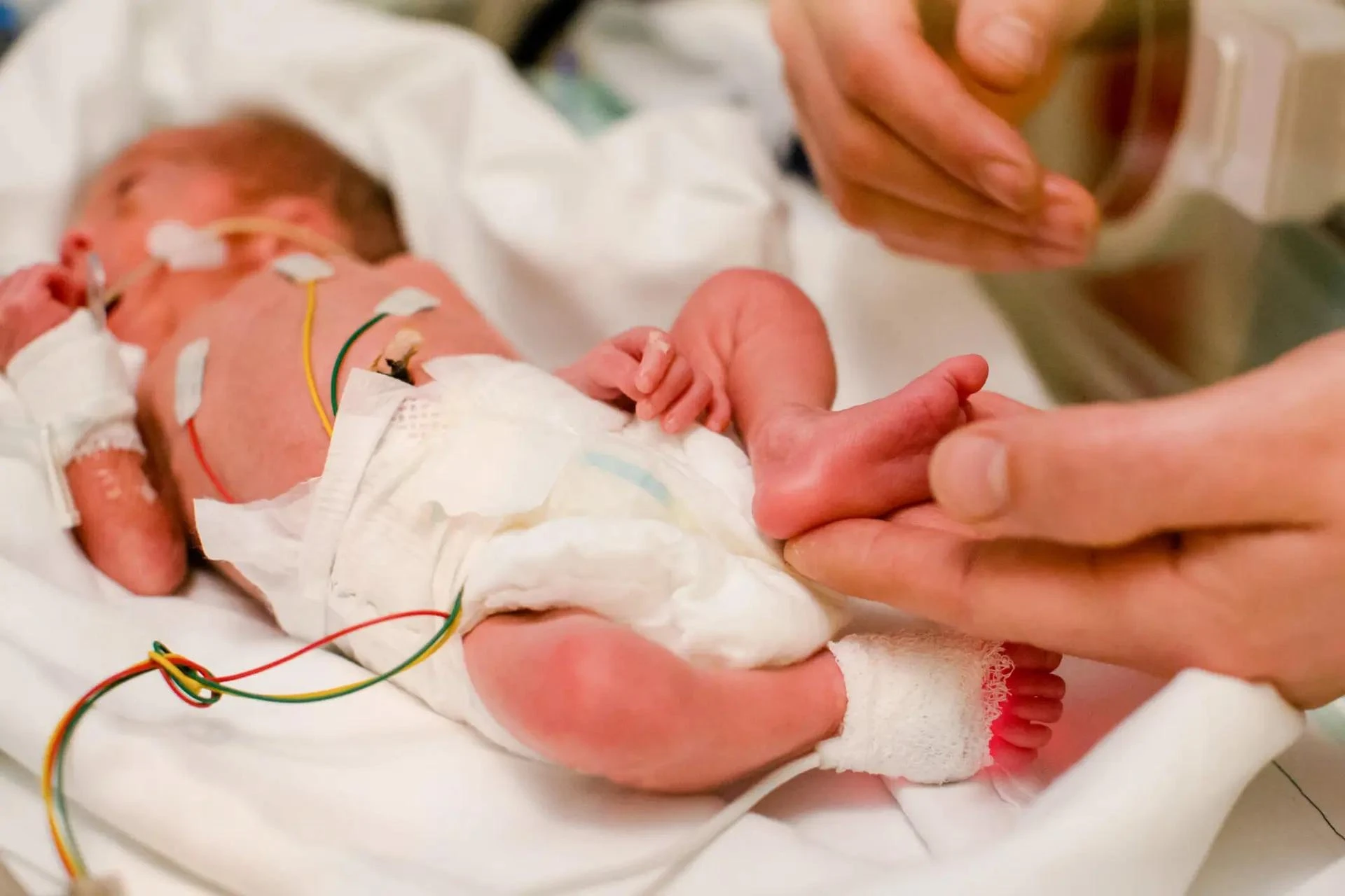 Understanding PPHN in Newborns: Causes, Symptoms, and Treatments in Coimbatore