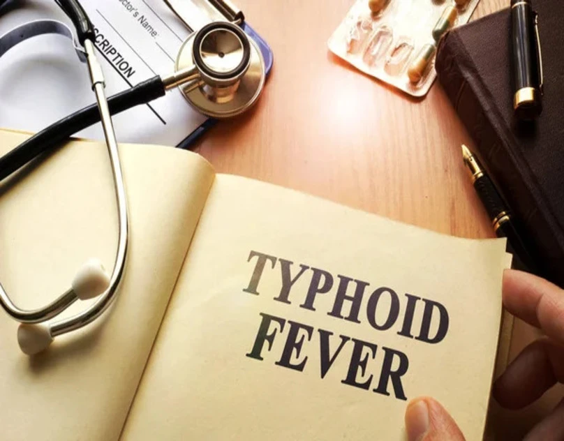 How to Recognize and Manage Typhoid Fever