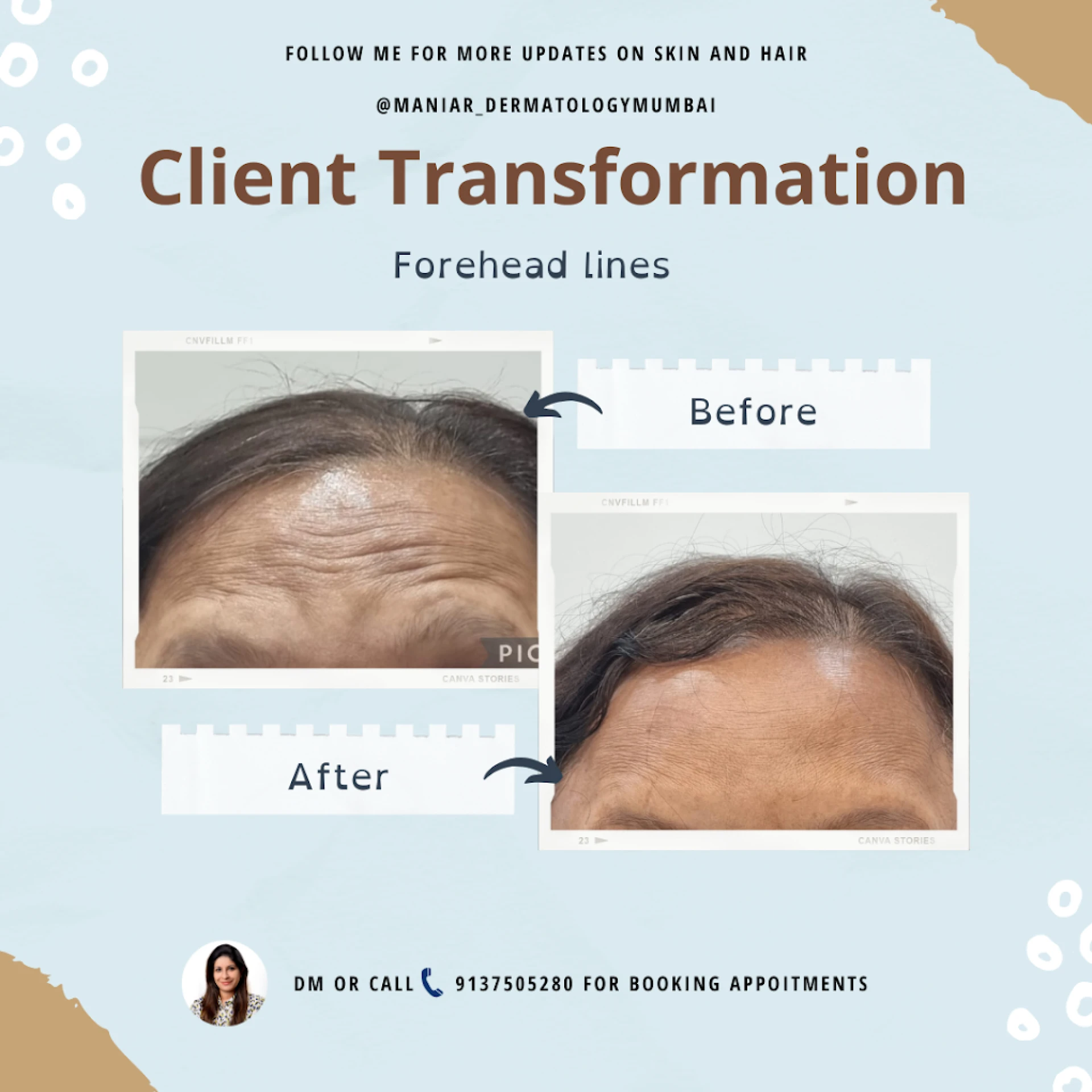 Hair Specialist in Chembur for Advanced Hair Treatments - Dr. Avani Maniar