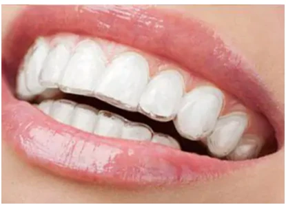 The Only Tips You Need to Maintain Your Invisalign
