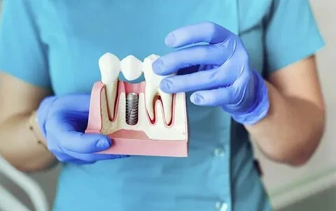 Affordable Root Canal Treatment: Exploring the Cost in India