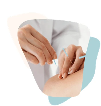 Why More People Trust Mississauga Acupuncture for Natural Healing?