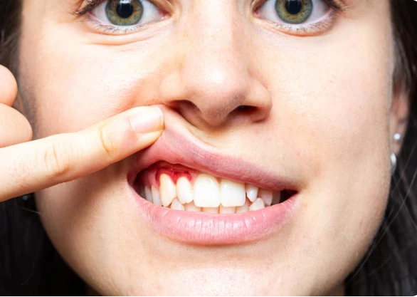 Victoria’s Best Cosmetic & Emergency Dental Treatments Explained