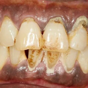 Victoria’s Best Cosmetic & Emergency Dental Treatments Explained