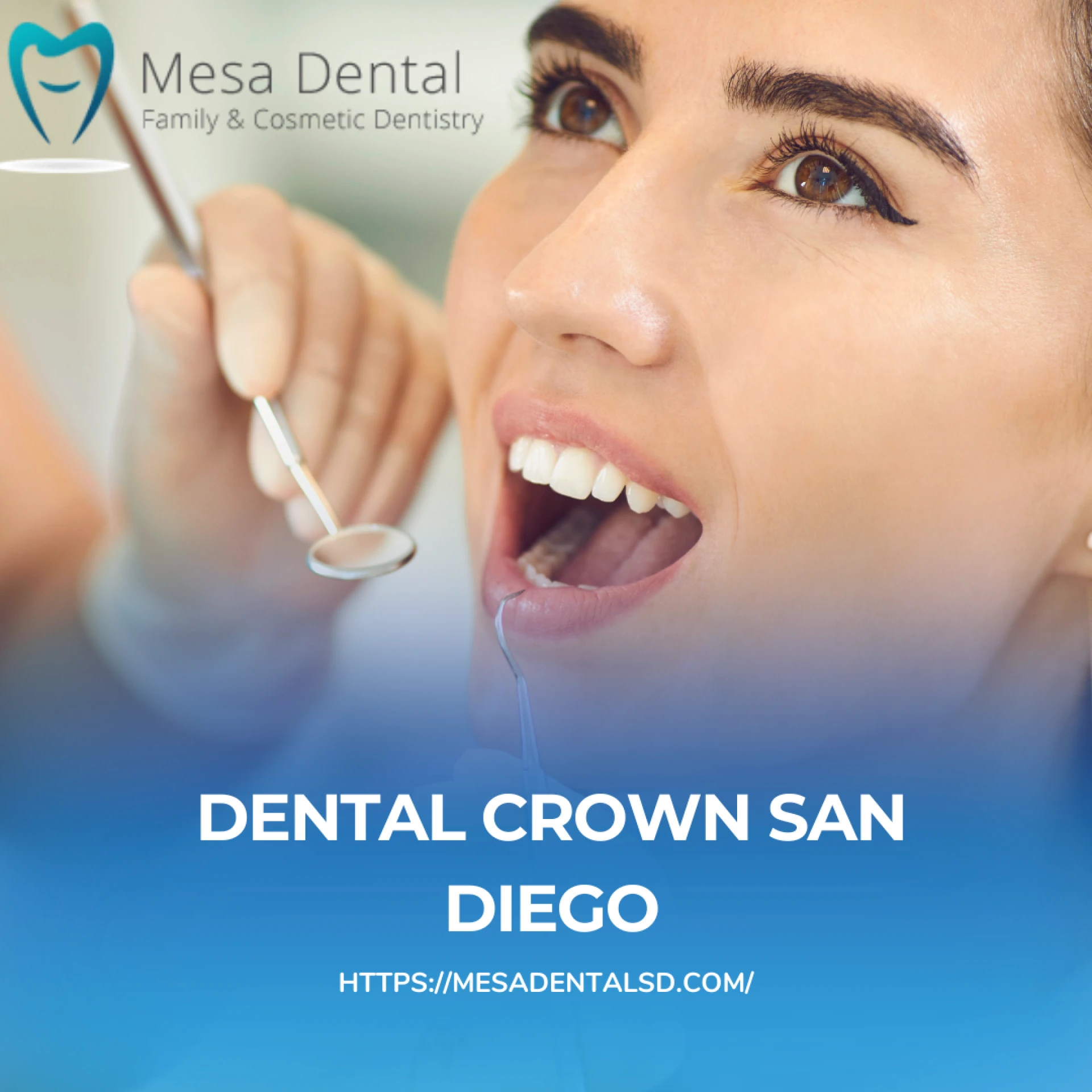 Why San Diego Smiles Shine Brighter: 7 Benefits of Dental Crowns and Implants