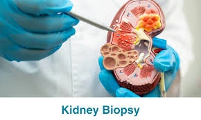 How a Kidney Biopsy Can Save Your Health