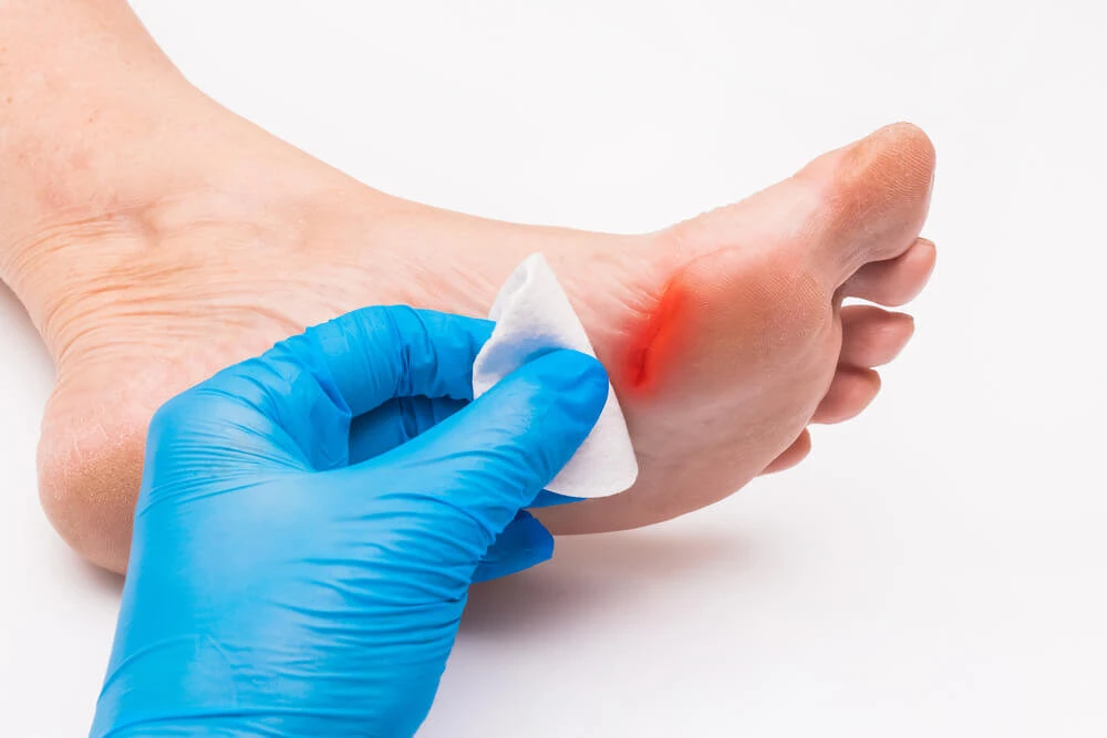 Top-Rated Diabetic Wound Care Specialist NYC with Dr. Karpenko