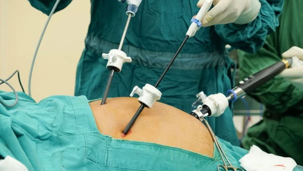 Gallbladder Stone Treatment in Delhi: Safe, Simple, and Affordable