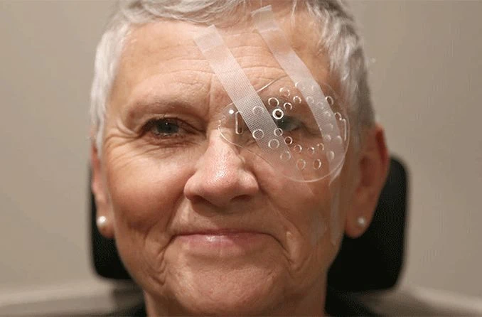 What to Know About Implantable Contact Lenses