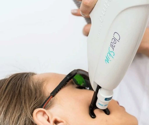 What Is HIFU Treatment? Smarten Up Your Skin