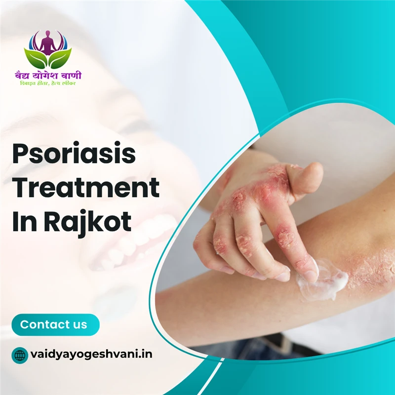 What Are the Cost-Effective Psoriasis Treatments in Rajkot