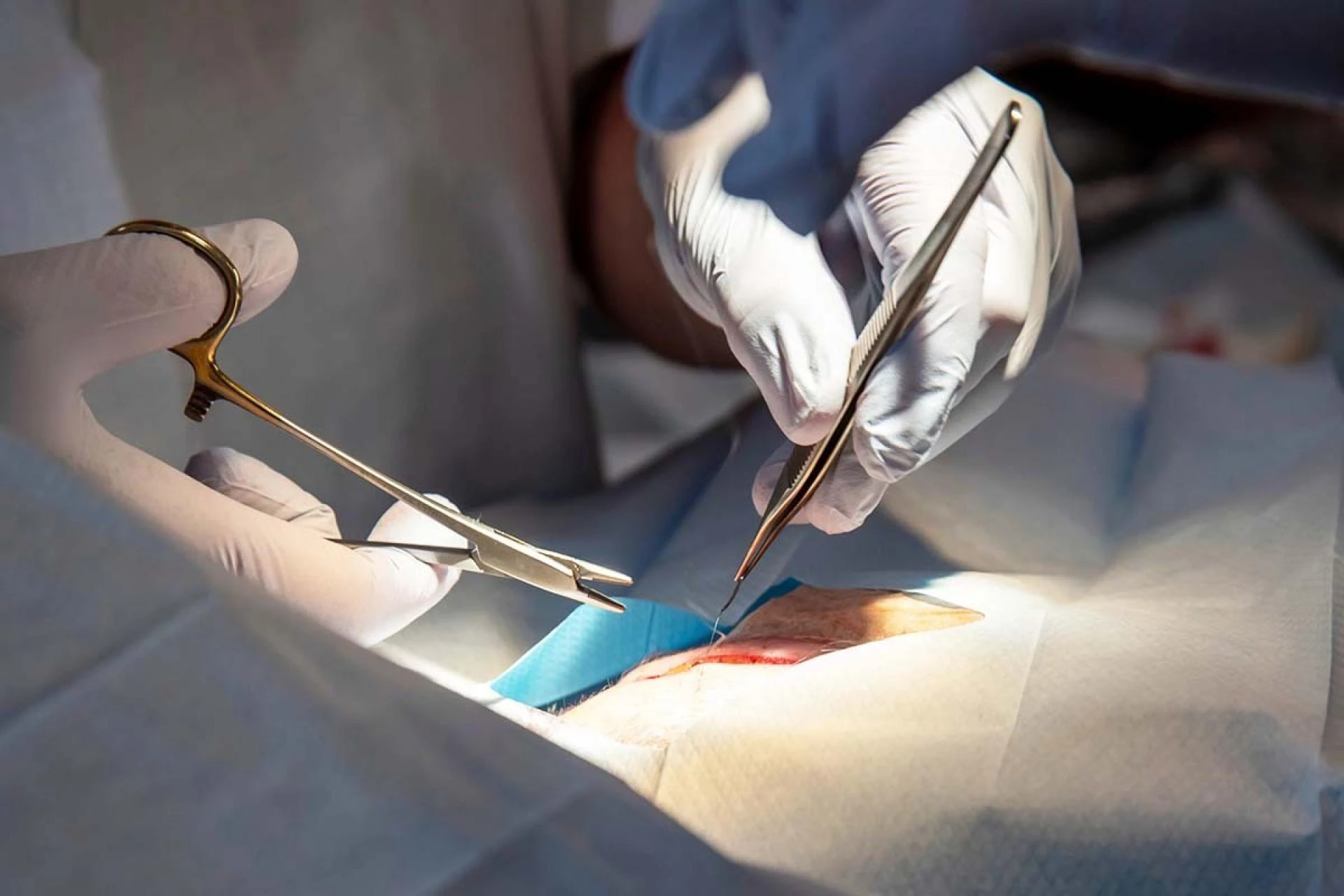Consult the Best Cancer Specialist in Delhi at Lyfe Medicare Cancer Center