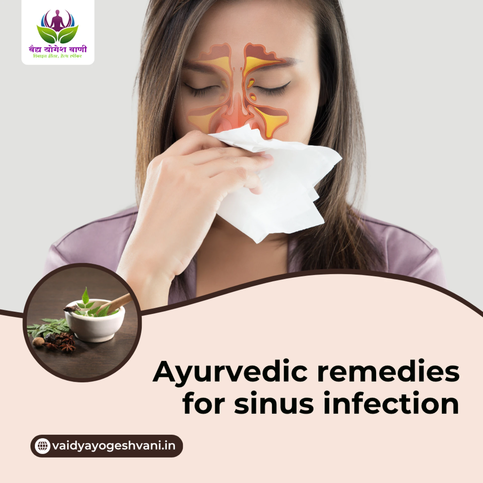 What Are the Best Ayurvedic Remedies for Sinus Infection