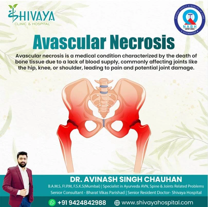 Trending Now: Ayurvedic Bone Regeneration Therapies for AVN (2025)